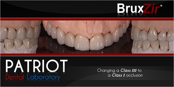 BruxZir Solid Zirconia