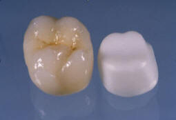 Zirconia crown