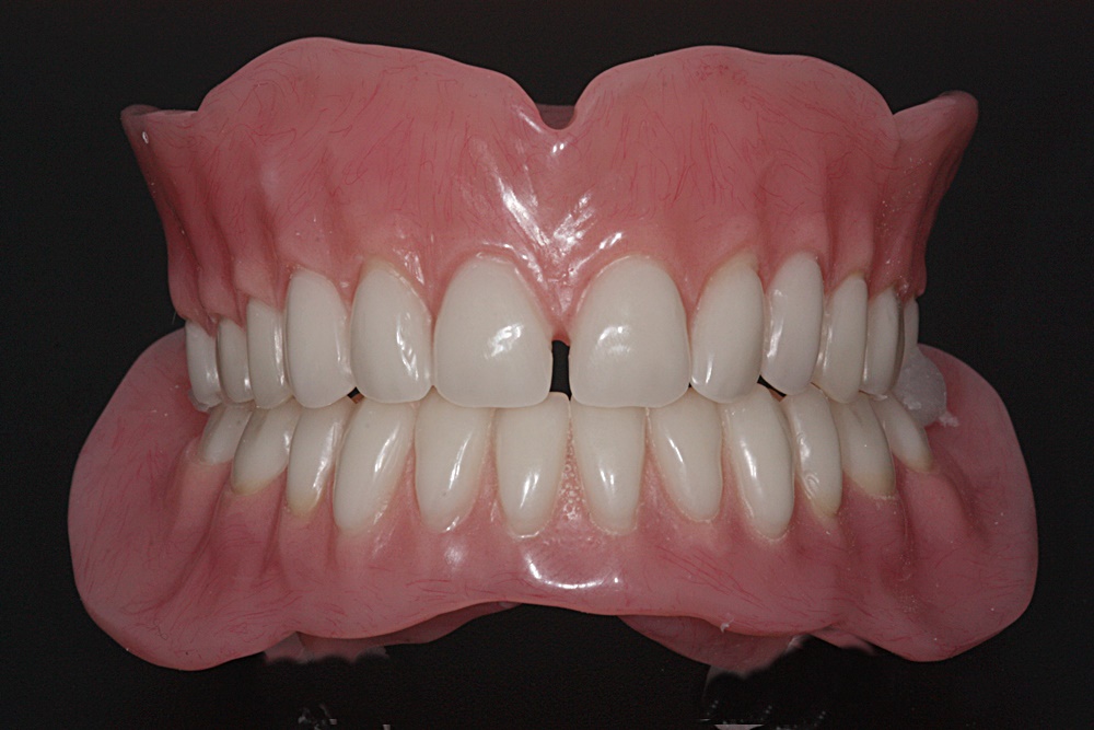 Denture close-up