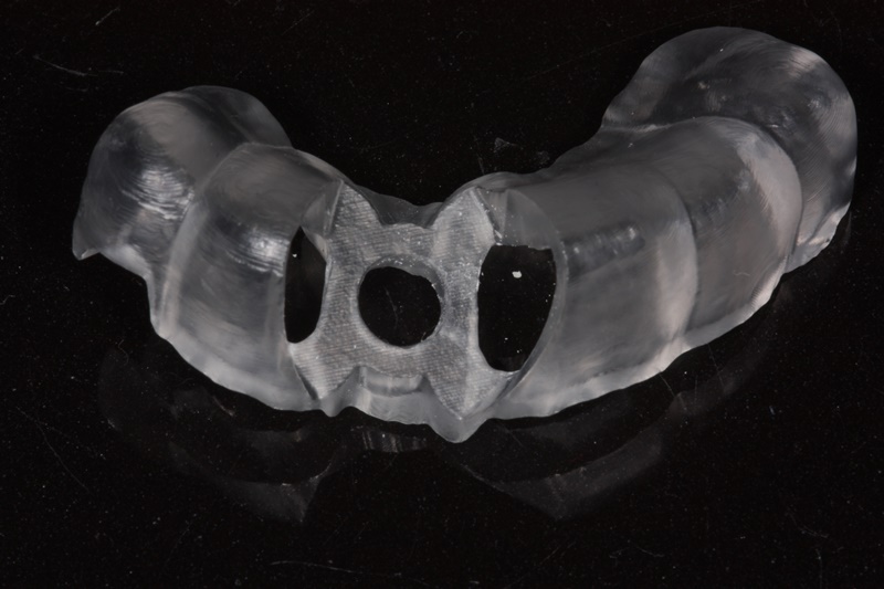 Digital Surgical Guide | Dental Lab Network